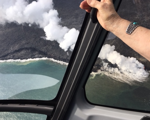 vertigo therapy anyone.